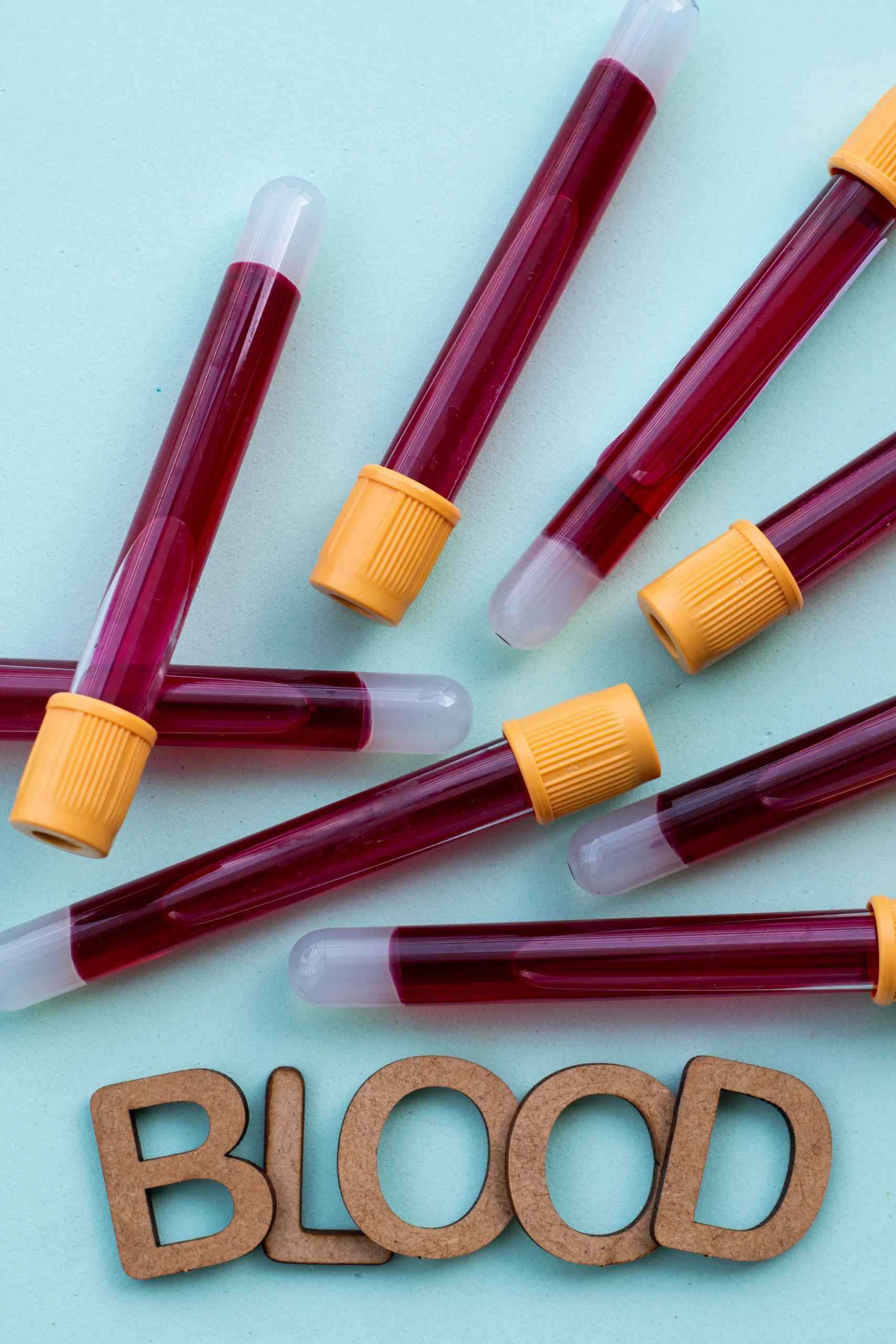 vaccum tube of blood