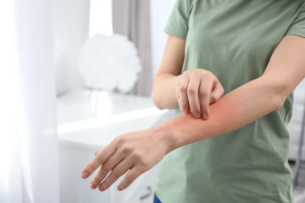 Person scratching an itchy, irritated area of skin