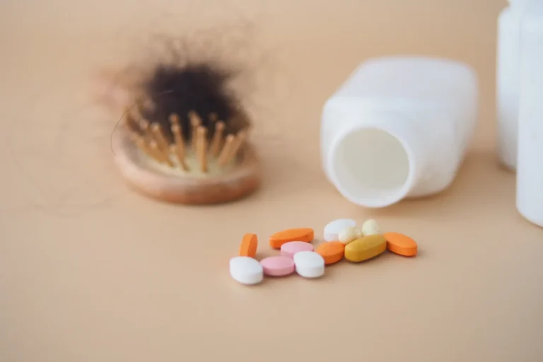 Does Metformin Cause Hair Loss?