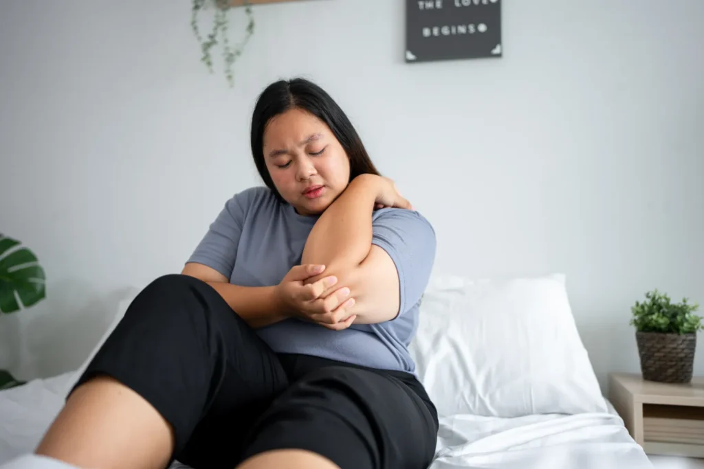 Woman holding her swollen arm due to discomfort.